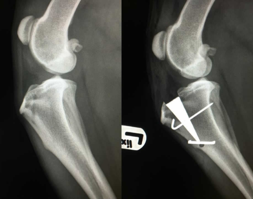 Cruciate and knee surgery
