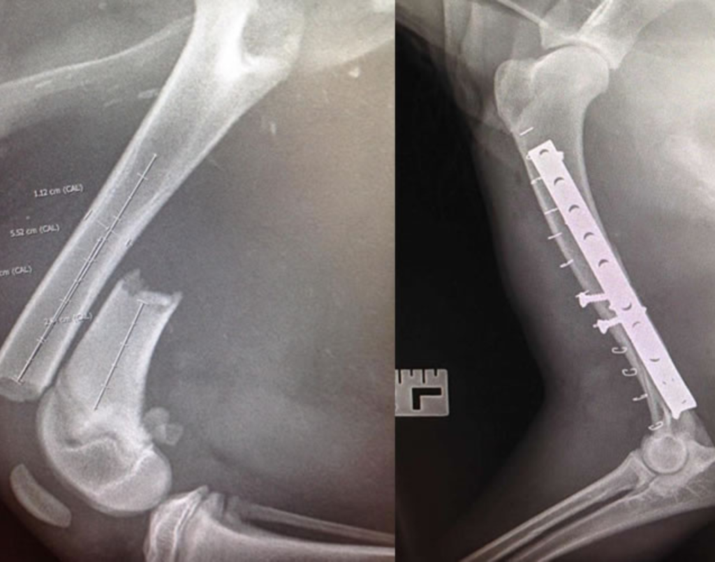 Complex Fracture Repair